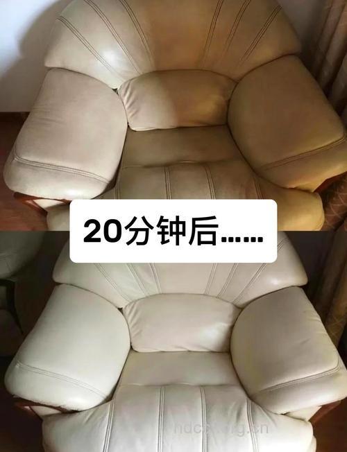 舒适的沙发对睾丸有伤害