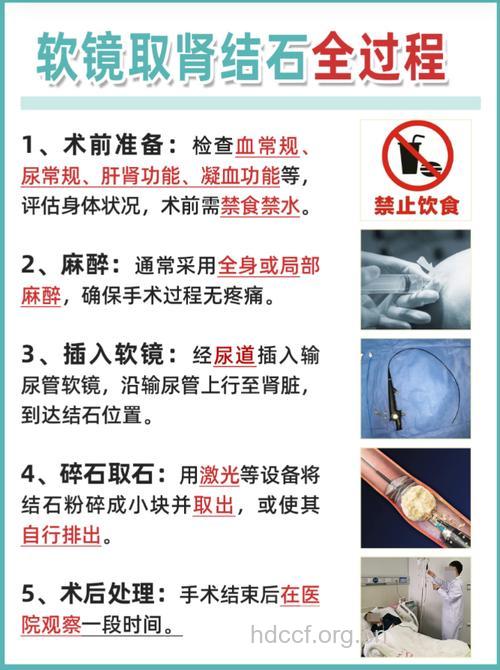 输尿管结石如何选择治疗手段