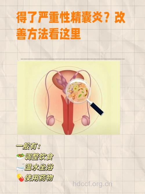 教你如何护理精囊炎患儿