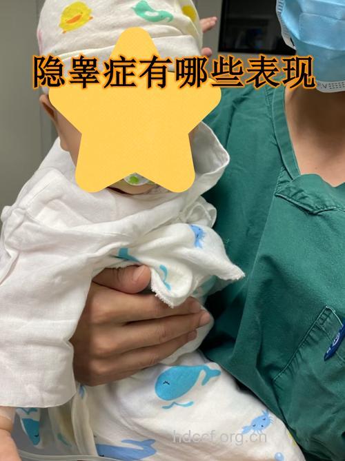 宝宝是不是得了隐睾症
