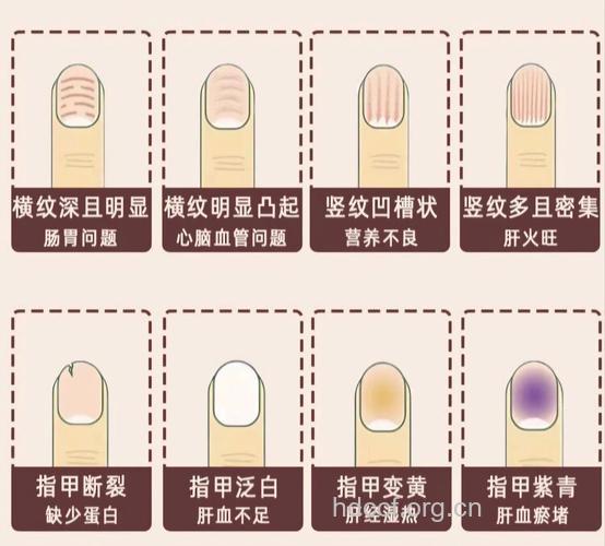 哪种指甲说明男人肾虚