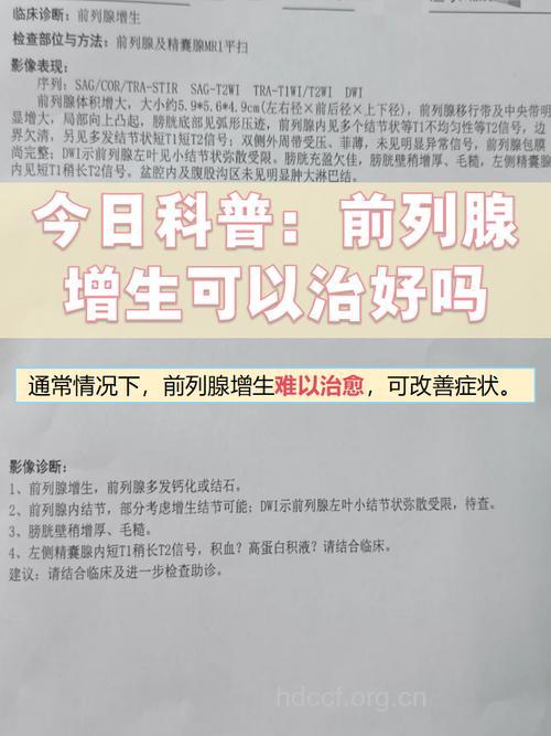 前列腺增生能完全治好吗