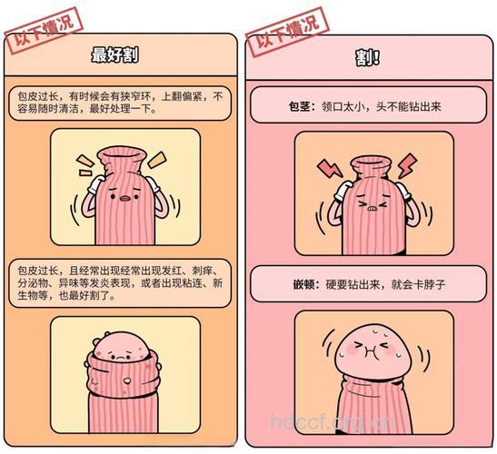 男人外生殖器的卫生注意了吗?