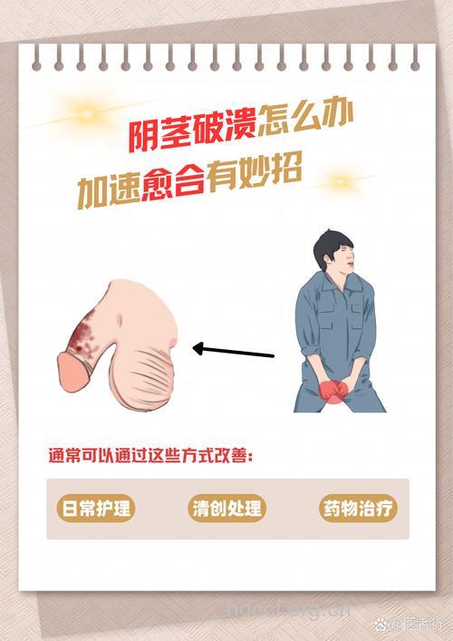 提防男人身体发生病变的迹象