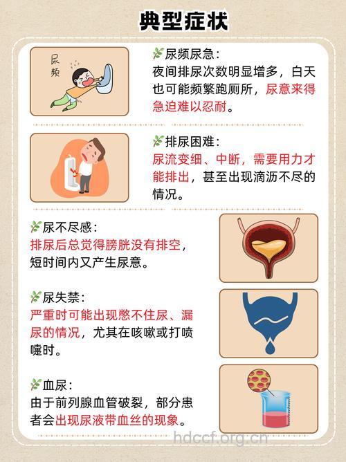 前列腺增生的临床表现