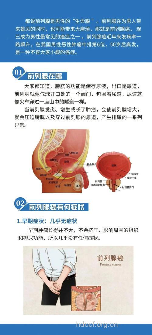 男人出现4个症状 小心是前列腺癌
