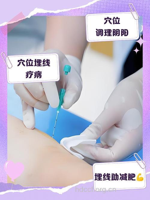 中医穴位埋线疗法有效治愈早泄