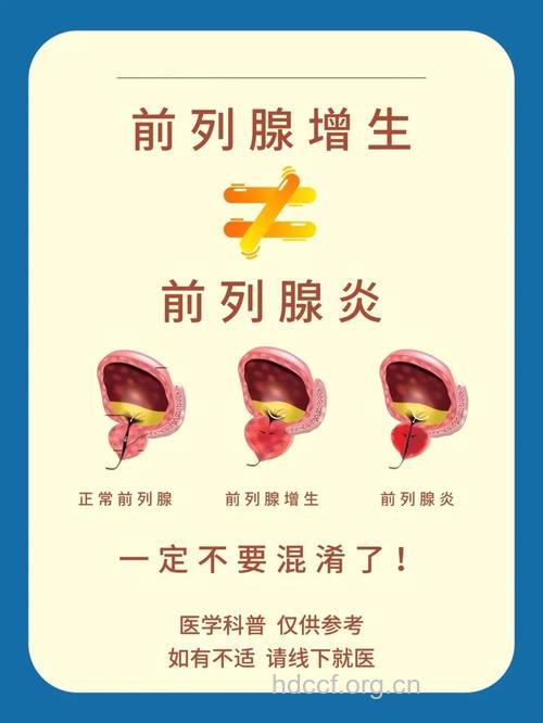 前列腺炎与早泄互相纠结
