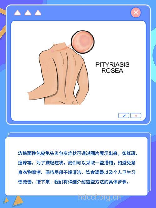 包皮龟头炎会自愈吗?解除男性生殖隐患
