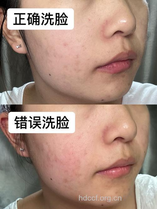早上洗脸常犯的四个错误