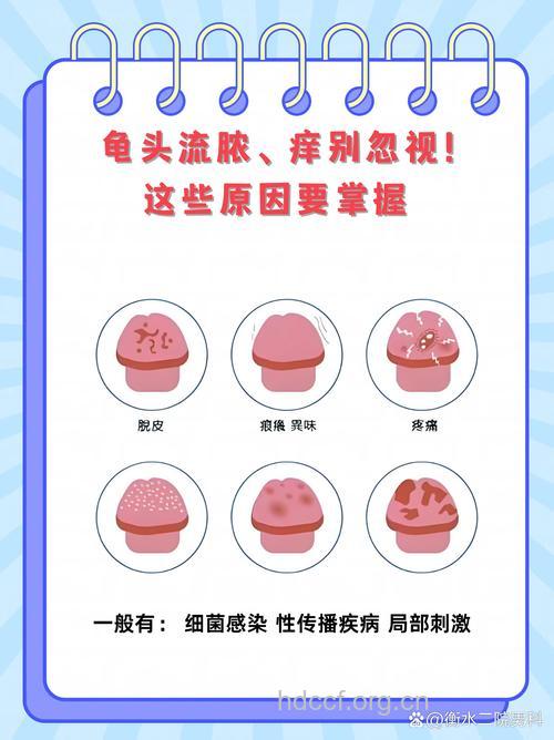 得了龟头炎怎么办 需对症治疗