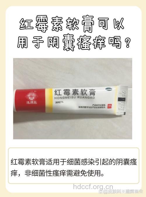 阴囊瘙痒脱皮用什么药