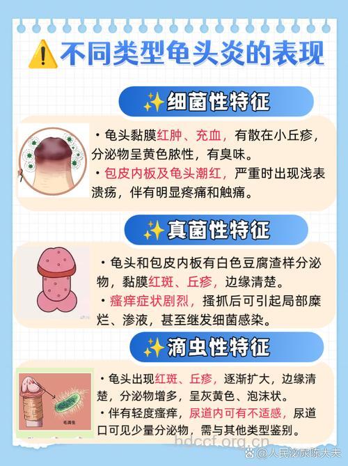 龟头炎治疗需分型 常见类型有哪些