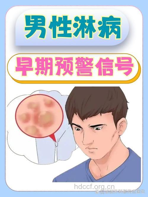 男人得性病有哪些表现 该如何预防