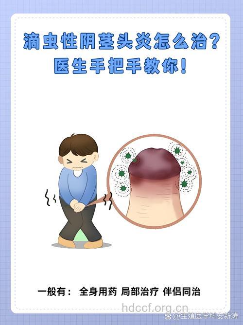 滴虫性龟头炎怎么治疗