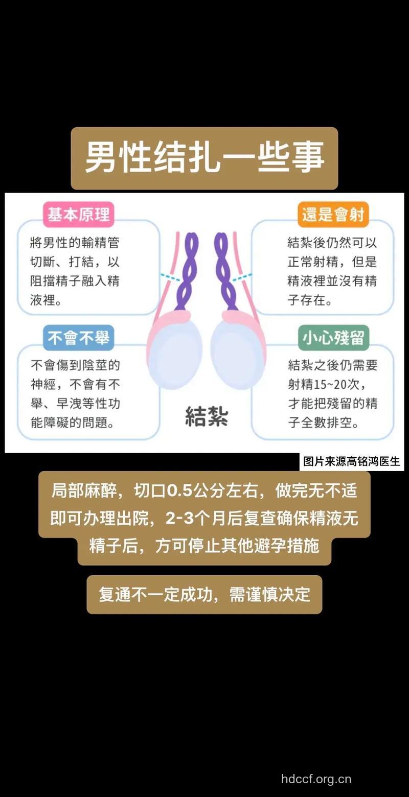 男性结扎会致阳痿 思想态度很重要