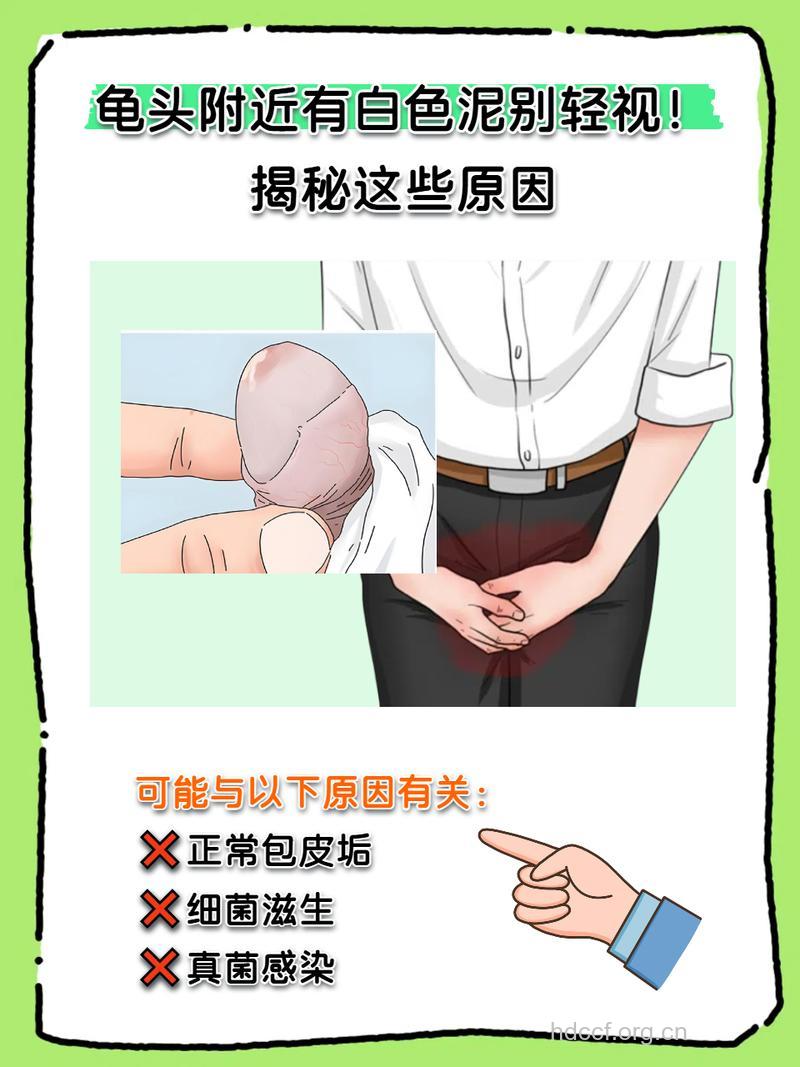 男人私处异味该怎么办