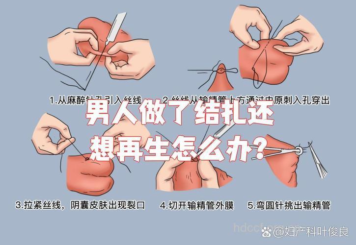 男性结扎后要怎么护理