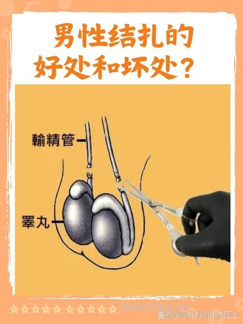 探秘男性结扎 男性结扎有何影响