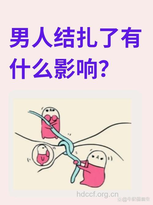 男人的心理怪圈 拒绝男人结扎