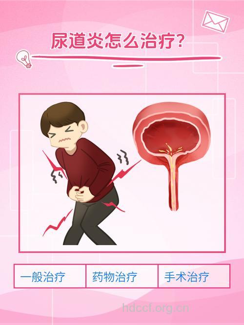 冬季小心尿道炎“卷土重来”