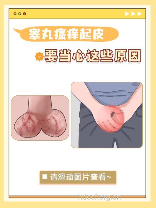 阴囊疼痛 附睾炎的4大症状表现