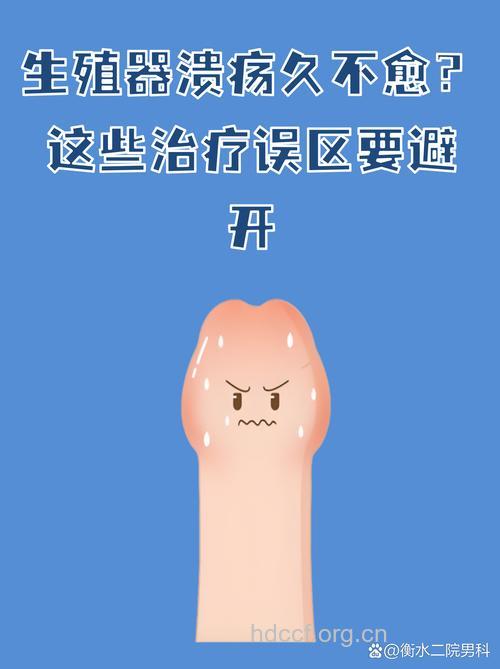 生殖感染的治疗误区有哪些