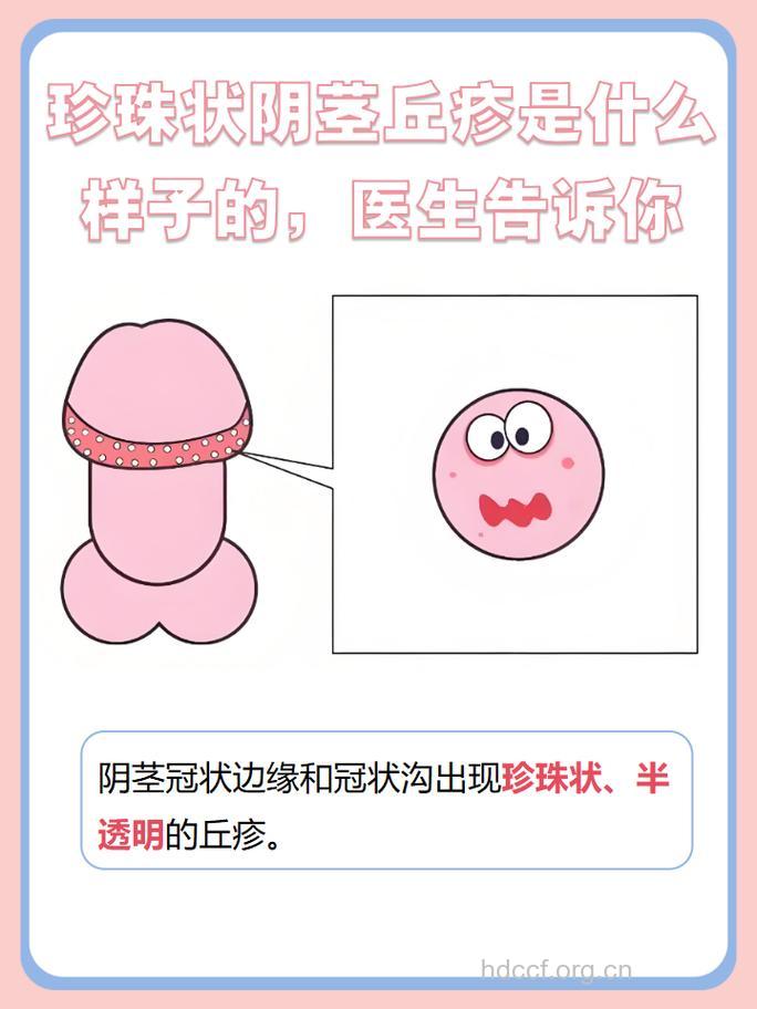 包皮阴茎头炎早期症状有哪些