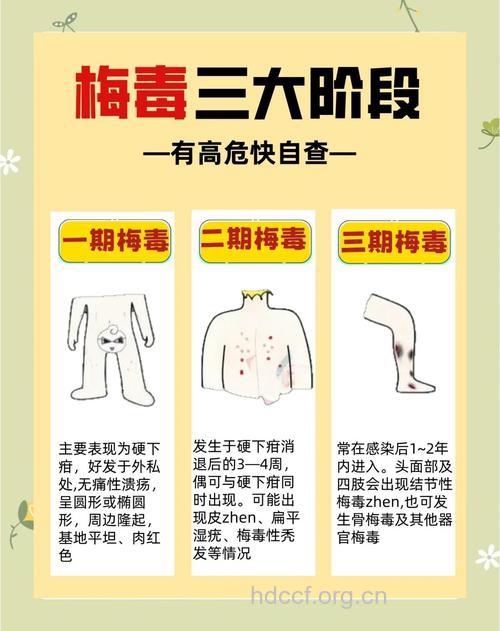 梅毒恶化分三期 想要治好需趁早