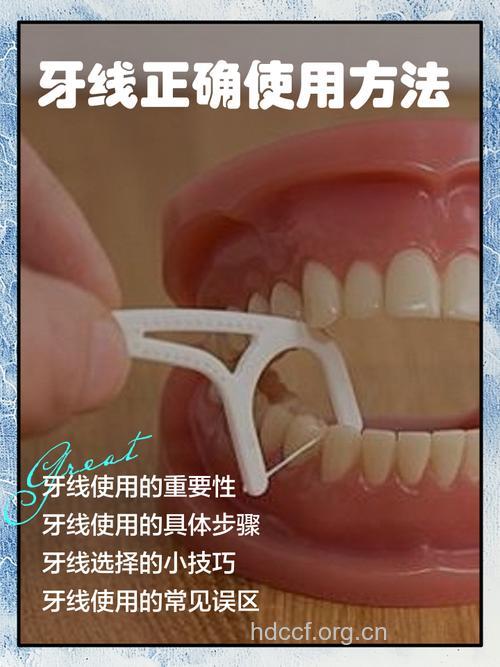 牙线有什么用 用牙线好吗