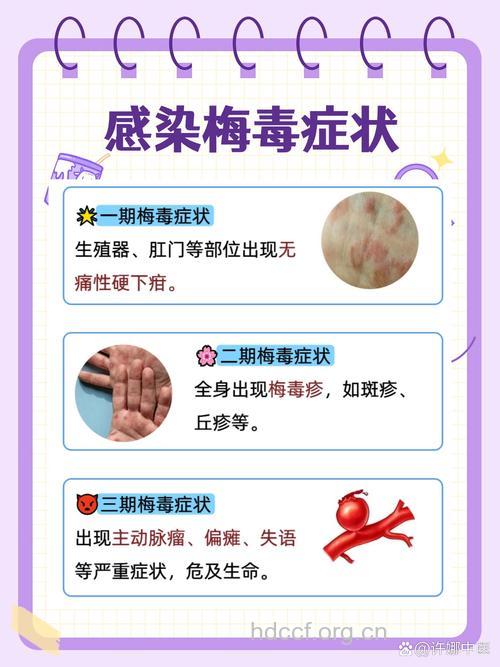 梅毒到底能不能被治愈