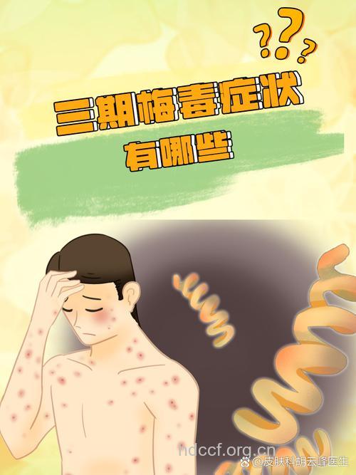 三期梅毒危及生命 患者不可掉以轻心