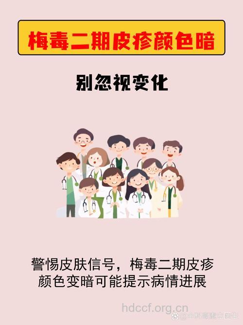 二期梅毒易复发 警惕4大复发原因