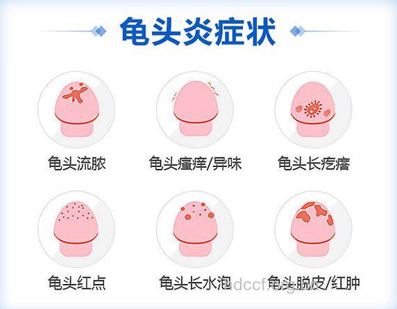 秋季来临 警惕男性生殖感染