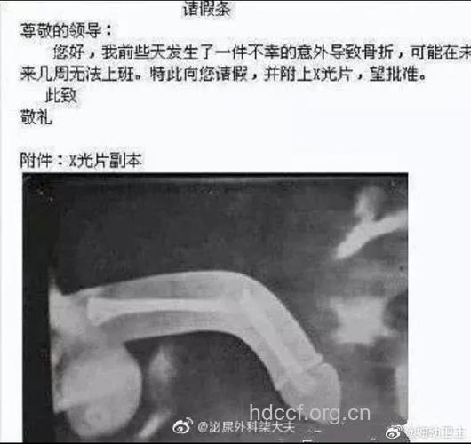 病例:遇公车艳遇 我的阴茎骨折了