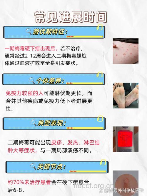 梅毒是怎么发展来的