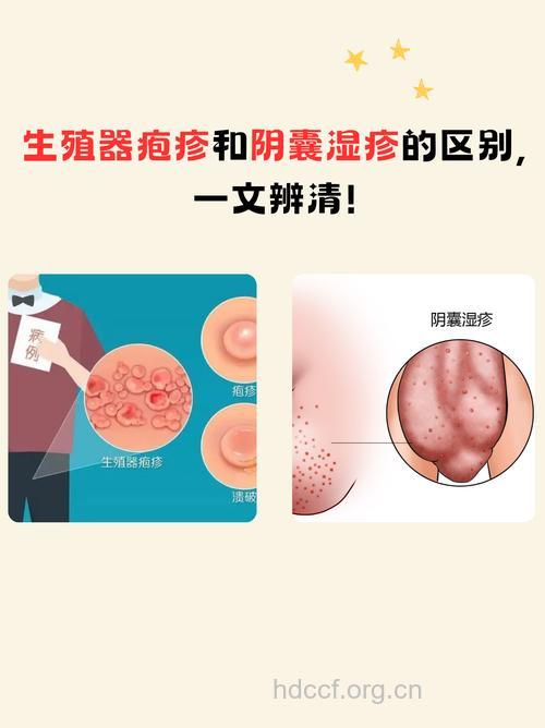 性病患者需要注意的地方