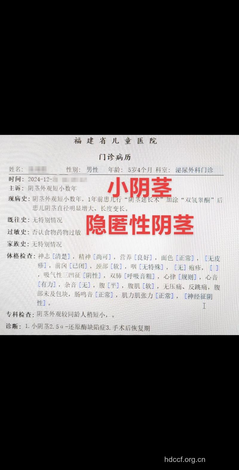 分享：阴茎短小治疗的成功病例