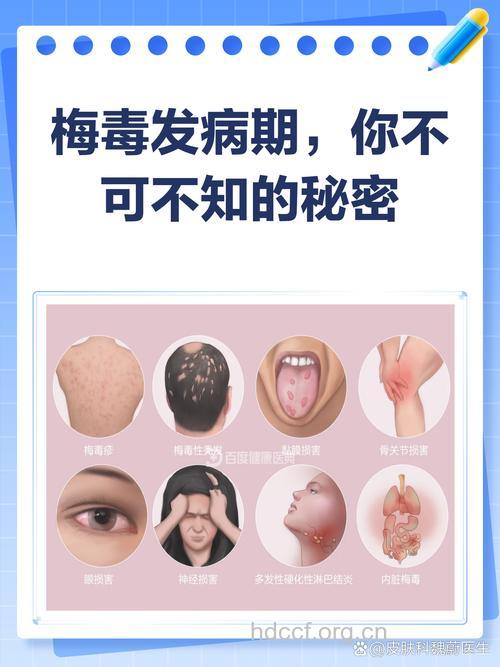 得了梅毒会导致死亡吗