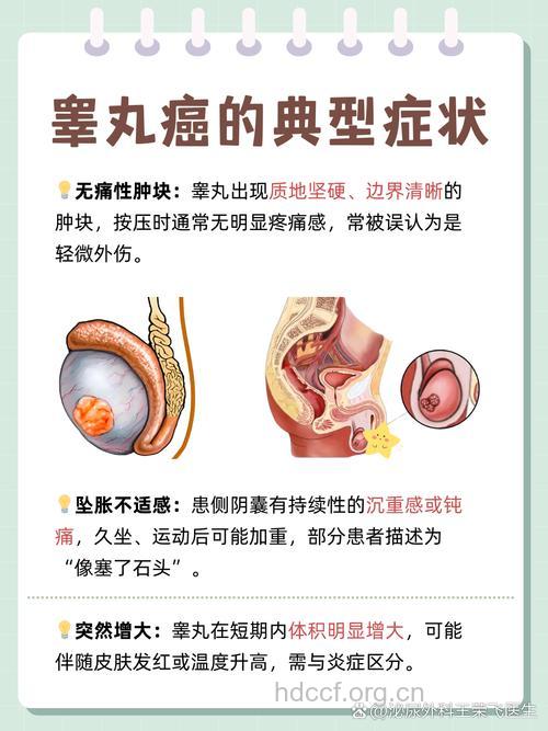 阴囊癌早期可防可治 中老年男性需谨慎
