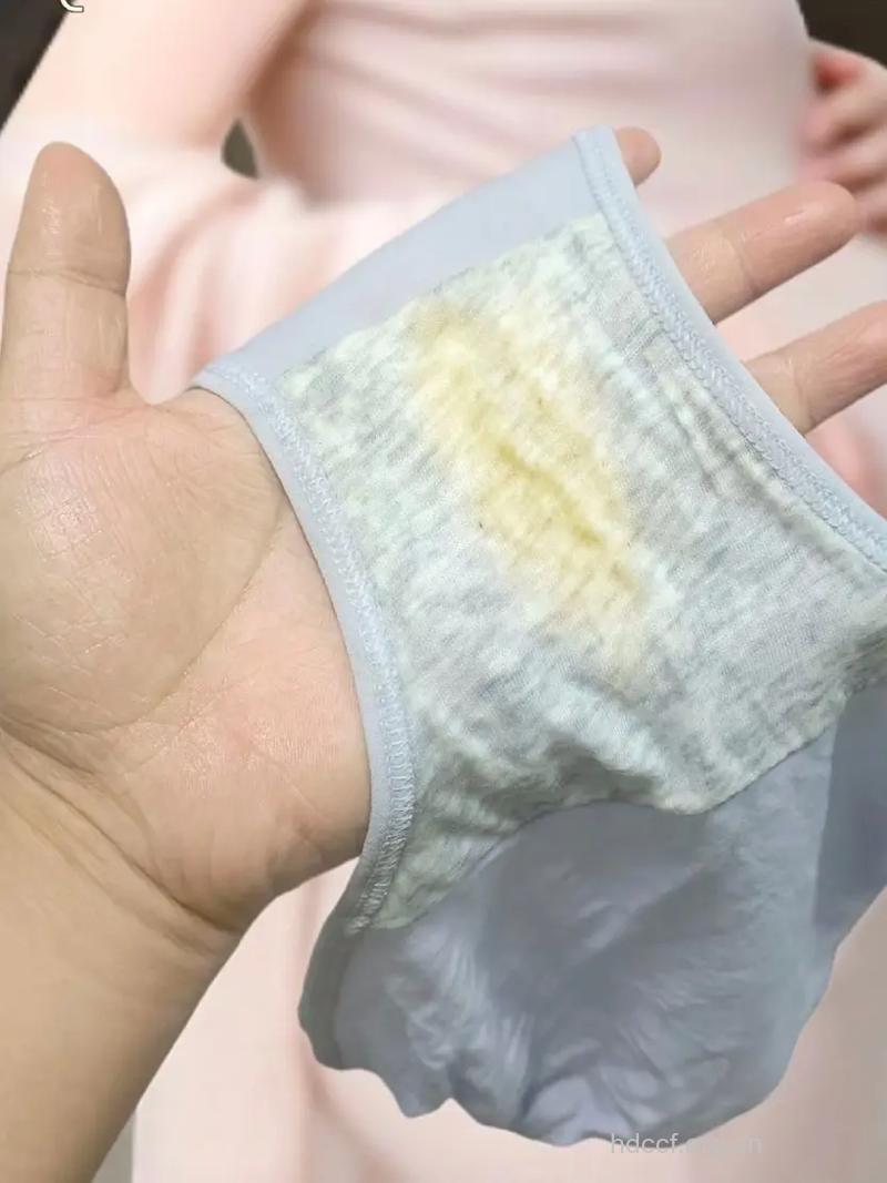女人内裤发黄就别穿了 当心造成这些伤害