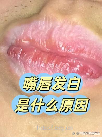 男人嘴唇发白是什么原因