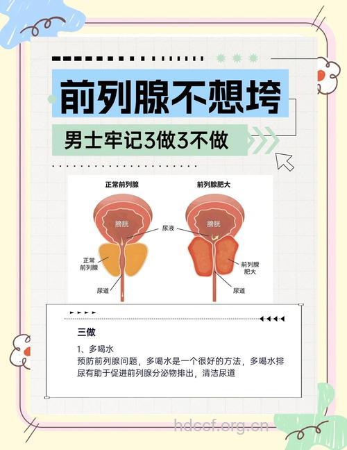 怎样正确保护前列腺
