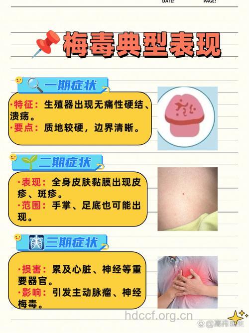 诱发梅毒的原因有哪些