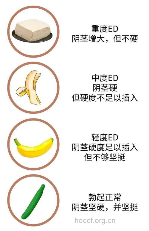 阴茎勃起硬度不够可这样缓解