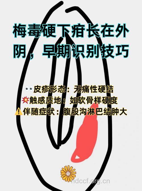 怎么正确认识隐形梅毒方法
