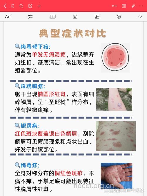 梅毒容易与哪些疾病混淆