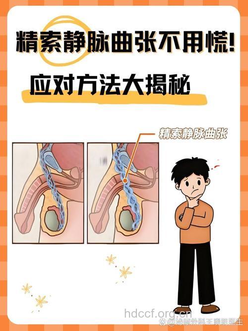 为什么精索静脉曲张会导致男性不育?