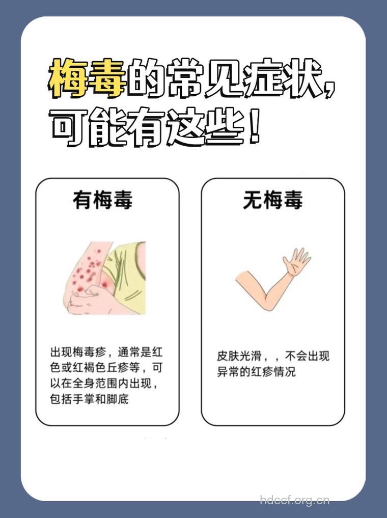 关于梅毒有哪些常见的类型