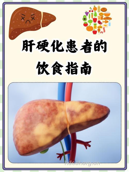 先天性梅毒性肝硬化的饮食原则